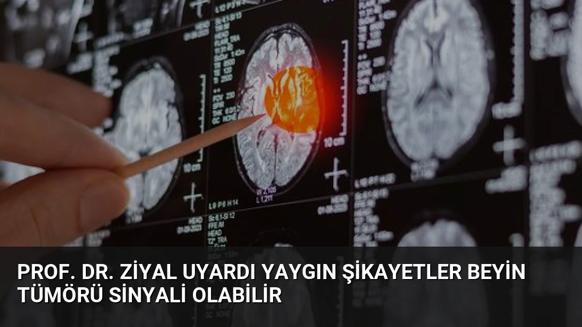Prof. Dr. Ziyal Uyardı Yaygın Şikayetler Beyin Tümörü Sinyali Olabilir