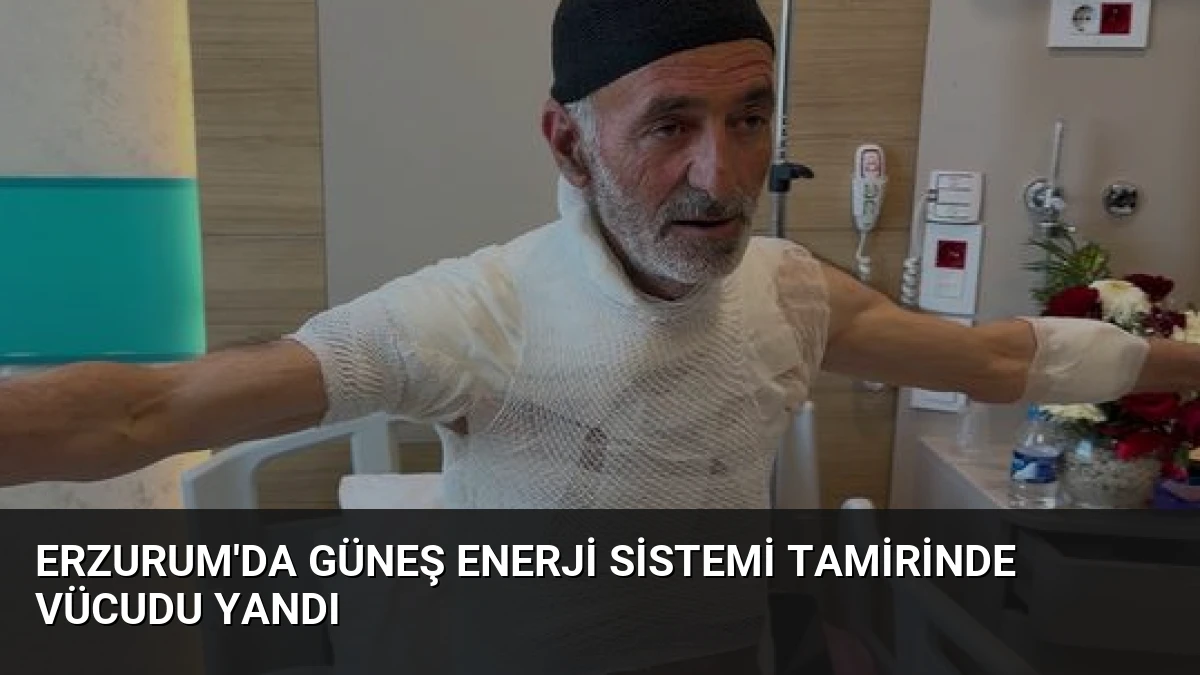 Erzurum’da Güneş Enerji Sistemi Tamirinde Vücudu Yandı