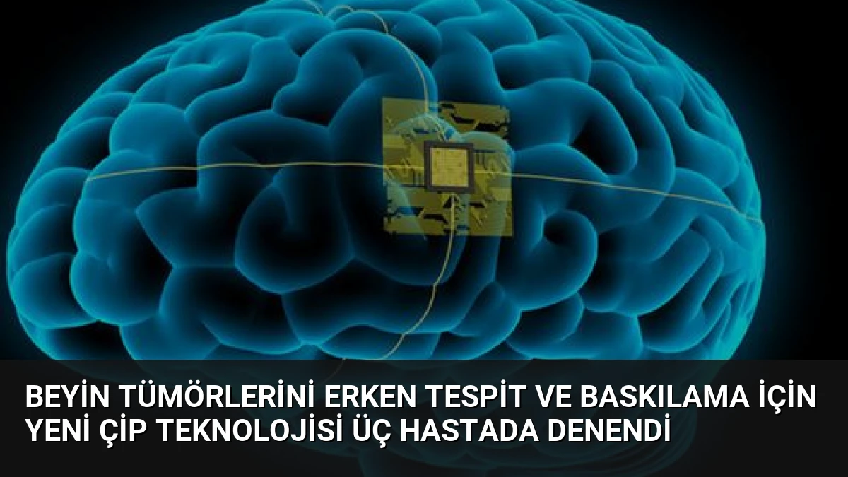 Beyin Tümörlerini Erken Tespit ve Baskılama İçin Yeni Çip Teknolojisi Üç Hastada Denendi