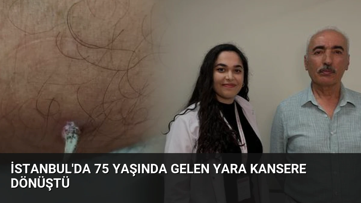 İstanbul’da 75 Yaşında Gelen Yara Kansere Dönüştü